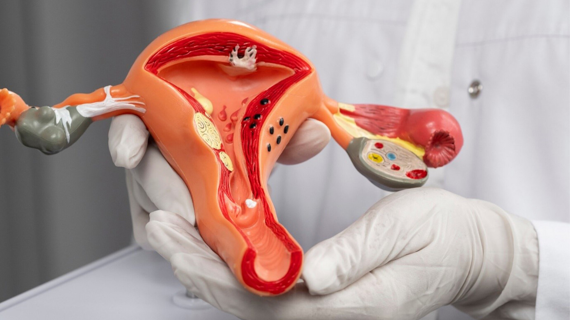  Early Detection of Cervical Cancer: Symptoms, Prevention, and Best Screening Solutions 